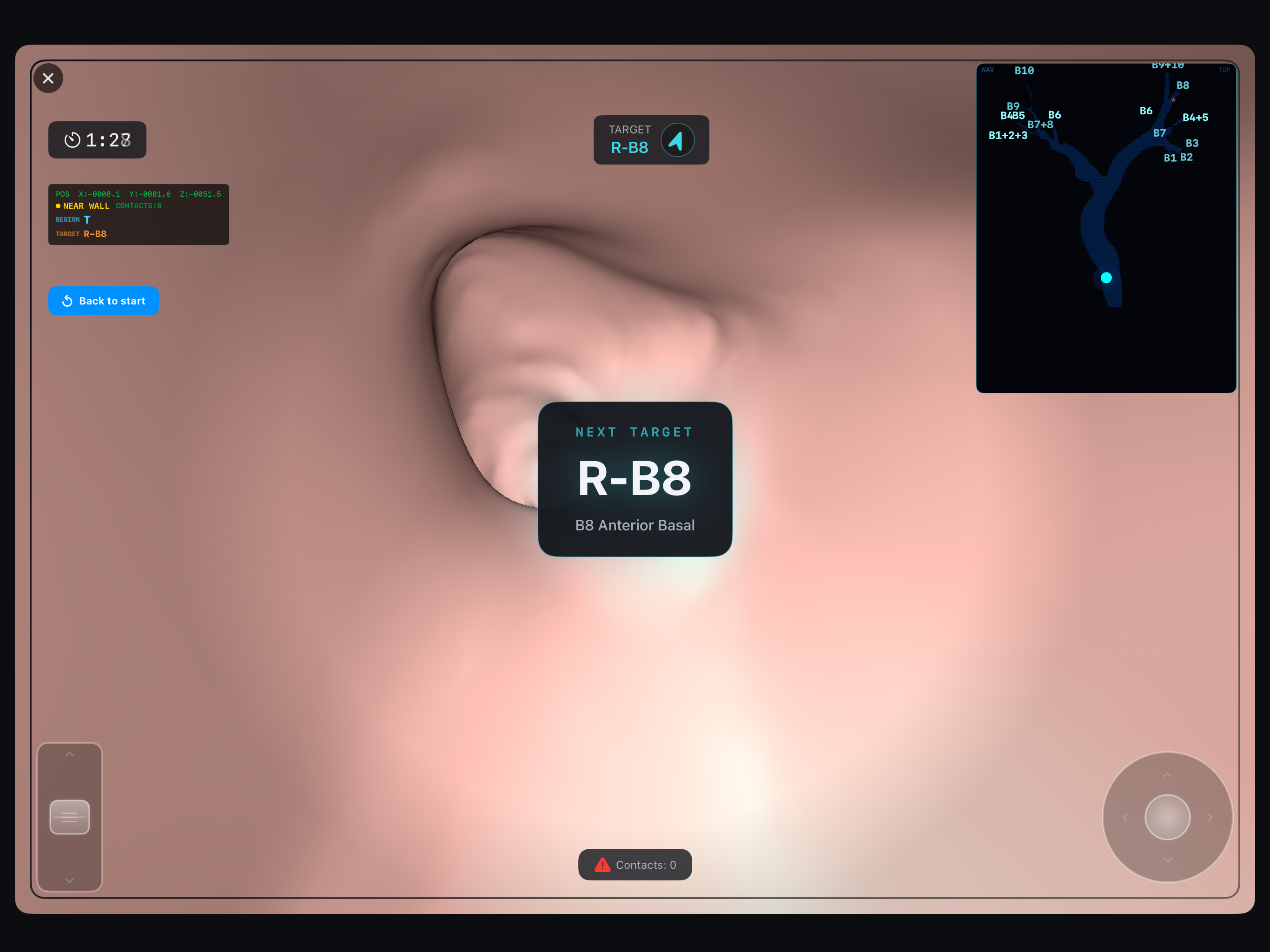 BronchoQuest - 統計画面。スコア、到達セグメント、プレイ時間などのデータ
